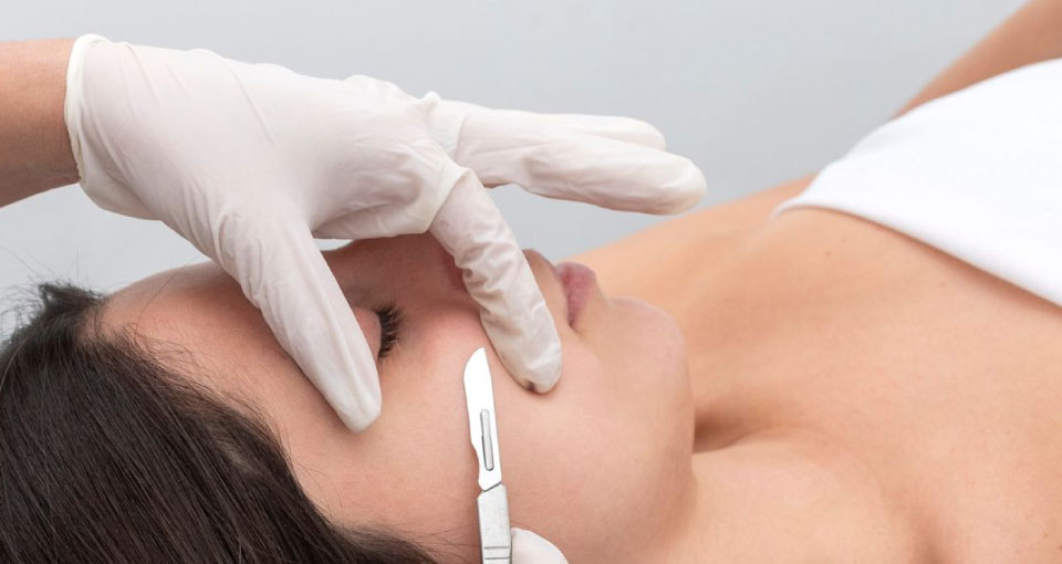 Dermaplaning