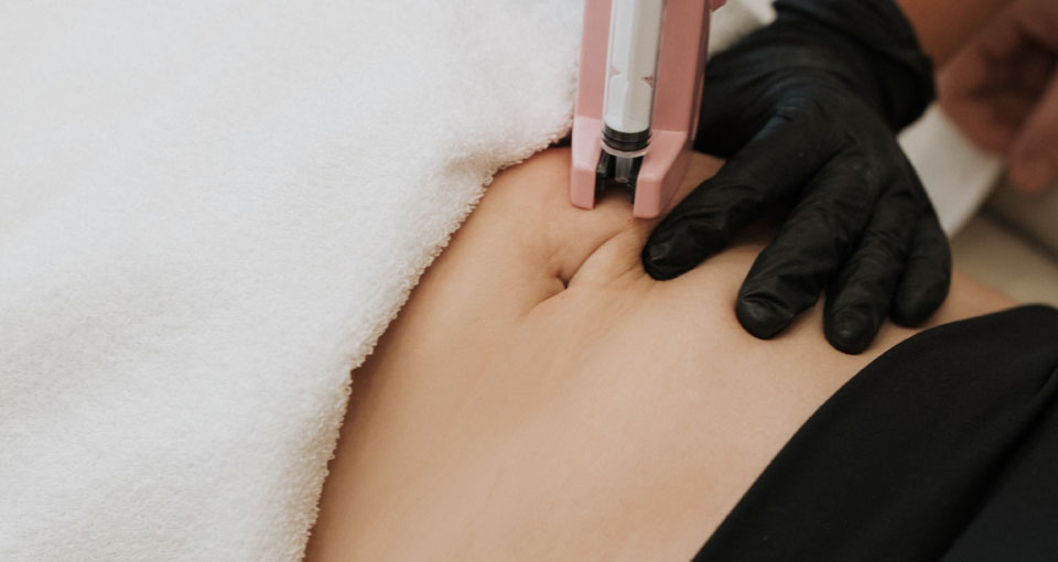 Tratamiento para celulitis