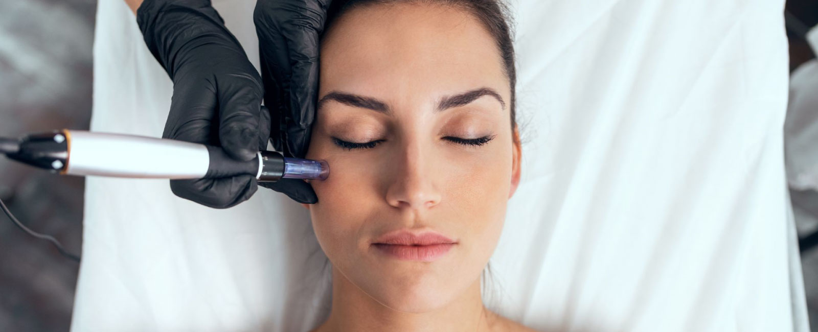 Dermaplaning