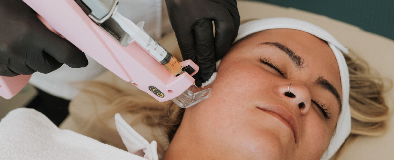 Plasma rico en plaquetas facial y corporal: