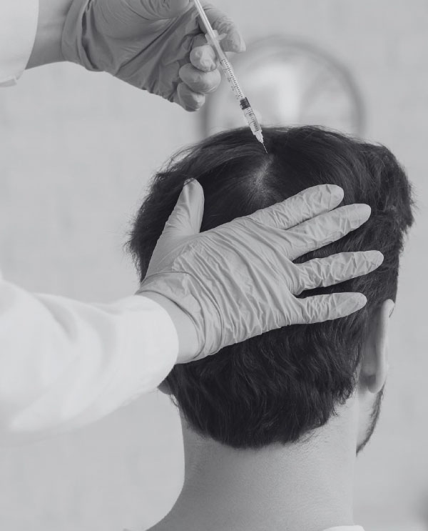 Mesoterapia facial
