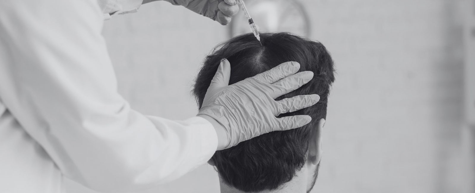 Mesoterapia facial